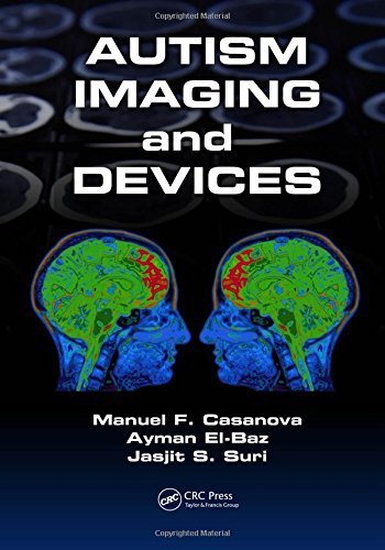 Autism Imaging And Devices Manuel F Casanova Ayman Elbaz Jasjit S Suri