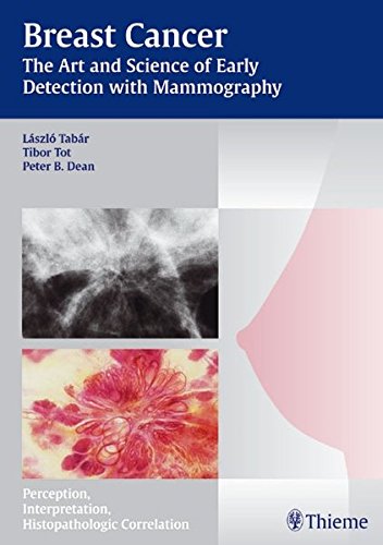 Breast Cancer The Art And Science Of Early Detection With Mammography Perception Interpretation Histopathologic Correlation 1st Edition Dean