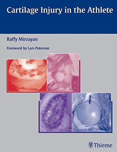 Cartilage Injury In The Athlete Mirzayan Raffy