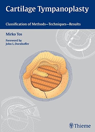 Cartilage Tympanoplasty Classification Of Methods Techniques Results 1st Edition Tos