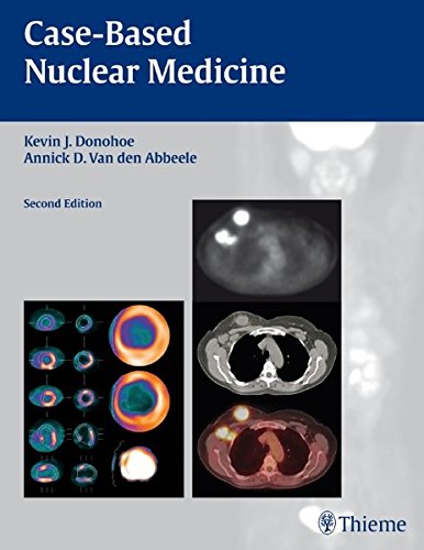 Casebased Nuclear Medicine 2nd Edition Van Den Abbeele Annick Donohoe