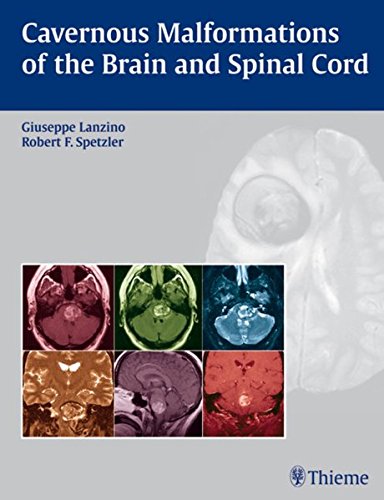 Cavernous Malformations Of The Brain And Spinal Cord 1st Edition Lanzino