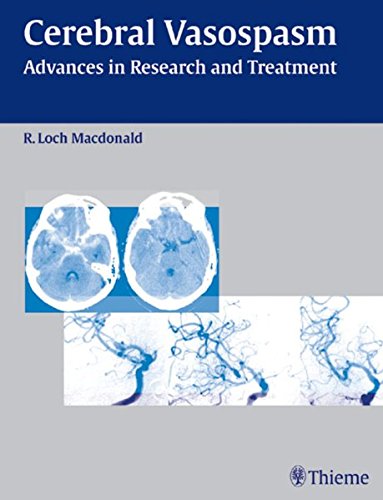 Cerebral Vasospasm Advances In Research And Treatment International Conference On Cerebral Vasospasm 8th 2003 Chicago Ill 1st Edition Macdonald