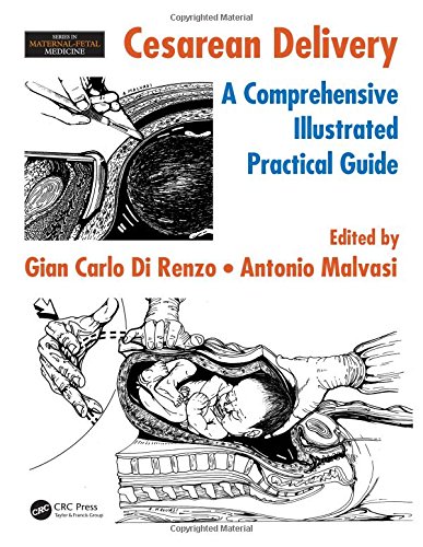 Cesarean Delivery A Comprehensive Illustrated Practical Guide 1st Edition Gian Carlo Di Renzo