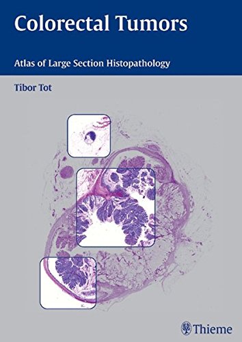 Colorectal Tumors Atlas Of Large Section Histopathology 1st Edition Tot