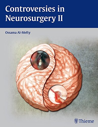 Controversies In Neurosurgery Ii 1st Edition Almefty Ossama