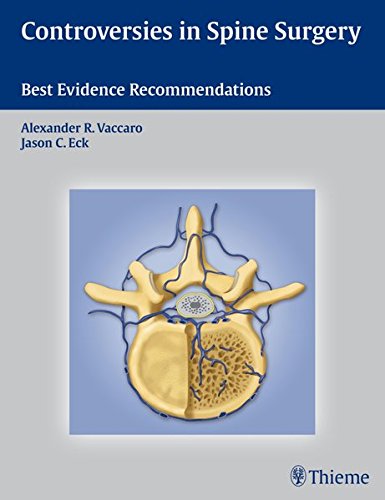 Controversies In Spine Surgery Best Evidence Recommendations 1st Edition Eck