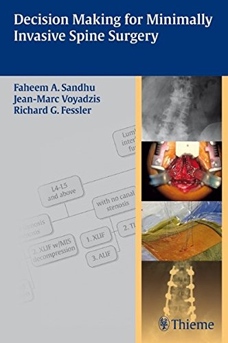 Decision Making For Minimally Invasive Spine Surgery 1st Edition Faheem A Sandhu