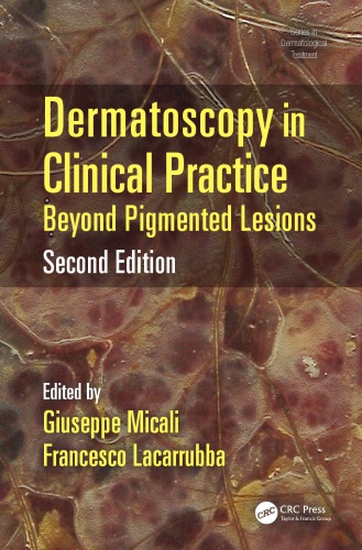 Dermatoscopy In Clinical Practice 2nd Edition Micali Giuseppe
