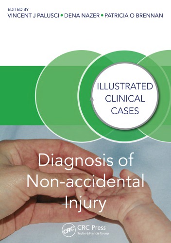 Diagnosis Of Nonaccidental Injury Illustrated Clinical Cases Brennan