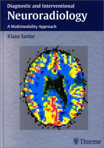 Diagnostic And Interventional Neuroradiology 1st Edition Sartor