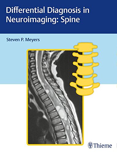 Differential Diagnosis In Neuroimaging Spine 1st Edition Steven P Meyers