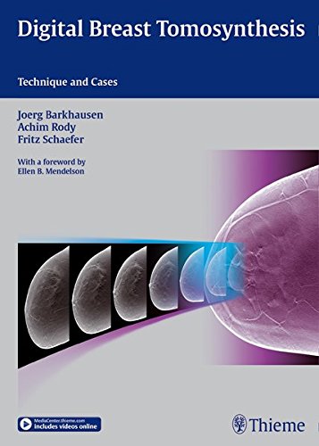 Digital Breast Tomosynthesis Technique And Cases 1 Pck Har Barkhausen
