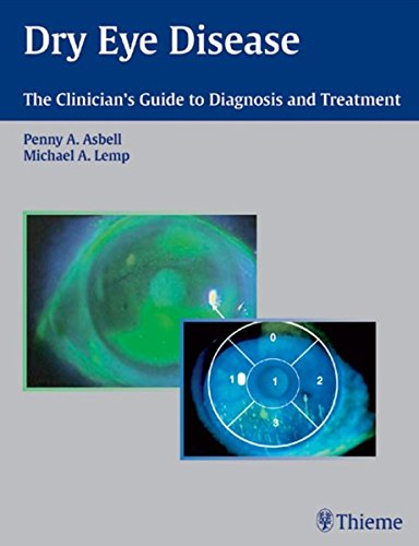 Dry Eye Disease The Clinicians Guide To Diagnosis And Treatment 1st Edition Penny A Asbell
