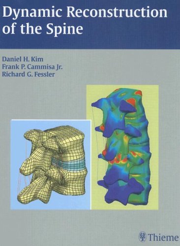 Dynamic Reconstruction Of The Spine 1st Edition Daniel H Kim