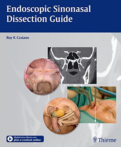 Endoscopic Sinonasal Dissection Guide 1 Spi Har Casiano Roy R