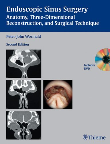 Endoscopic Sinus Surgery Anatomy Threedimensional Reconstruction And Surgical Technique 2nd Ed Peterjohn Wormald