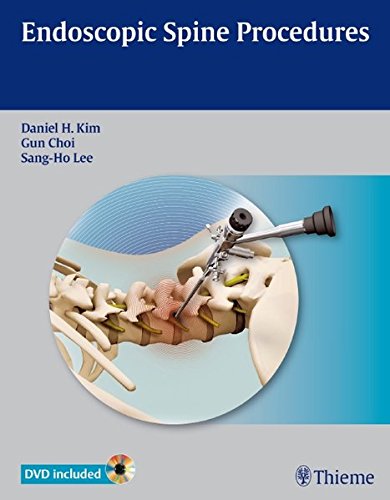 Endoscopic Spine Procedures 1 Hardvd Daniel H Kim Gun Choi