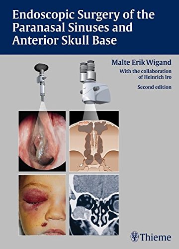 Endoscopic Surgery Of The Paranasal Sinuses And Anterior Skull Base 2nd Ed Malte Erik Wigand