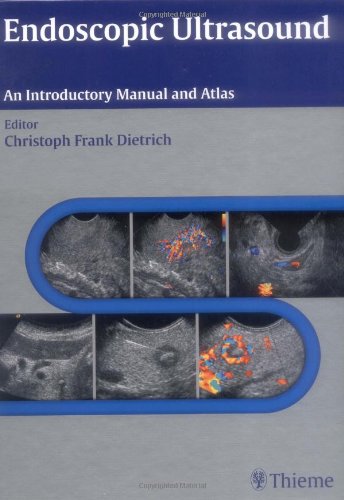 Endoscopic Ultrasound An Introductory Manual And Atlas 94 Tables Allgayer