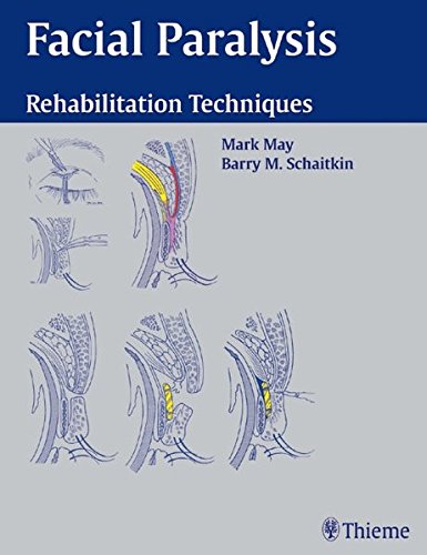 Facial Paralysis Rehabilitation Techniques May Mark Schaitkin