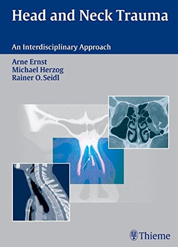 Head And Neck Trauma An Interdisciplinary Approach 1st Edition Michael Herzog