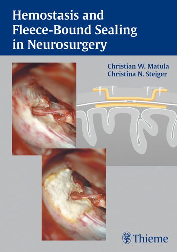 Hemostasis And Fleecebound Sealing In Neurosurgery 1st Edition Reddy