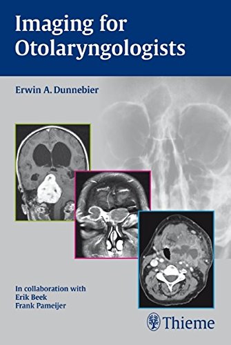 Imaging For Otolaryngologists 1st Edition Beek Erik Dunnebier