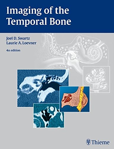 Imaging Of The Temporal Bone 4th Edition Loevner Laurie A Swartz