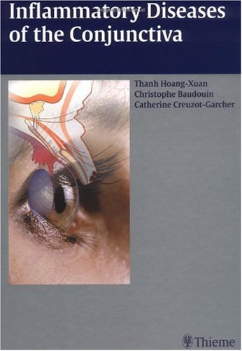 Inflammatory Diseases Of The Conjunctivae 1st Edition Thanh Hoangxuan