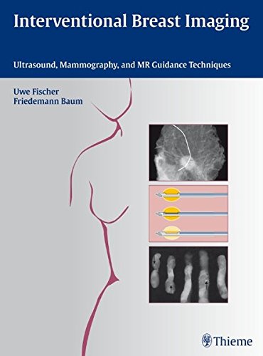 Interventional Breast Imaging Ultrasound Mammography And Mr Guidance Techniques 1st Edition Baum