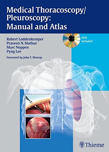 Medical Thoracoscopypleuroscopy Manual And Atlas 1 Hardvd Robert Loddenkemper
