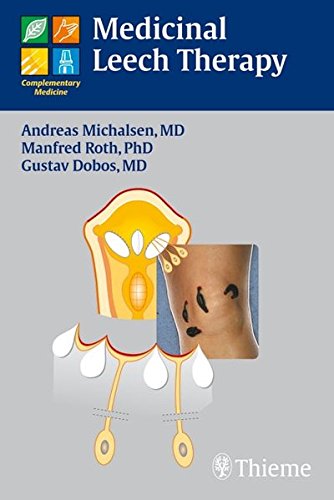 Medicinal Leech Therapy Andreas Michalsen Manfred Roth Gustav Dobos