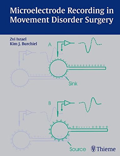 Microelectrode Recording In Movement Disorder Surgery Burchiel