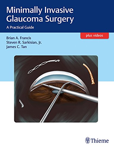 Minimally Invasive Glaucoma Surgery A Practical Guide 1 Harpsc Francis