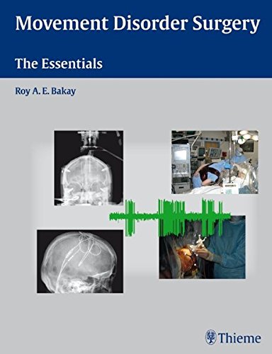 Movement Disorder Surgery The Essentials 1st Edition Bakay Roy A E