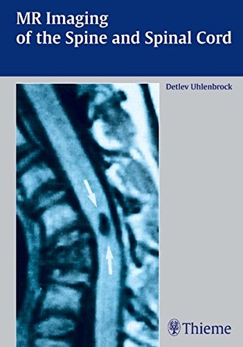 Mr Imaging Of The Spine And The Spinal Cord 1st Edition Larkin