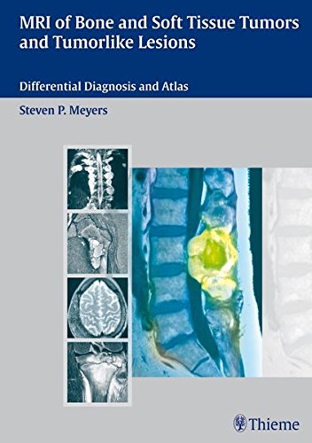 Mri Of Bone And Soft Tissue Tumors And Tumorlike Lesions Differential Diagnosis And Atlas 1st Edition Meyers