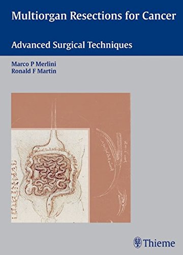 Multiorgan Resections For Cancer Advanced Surgical Techniques Merlini