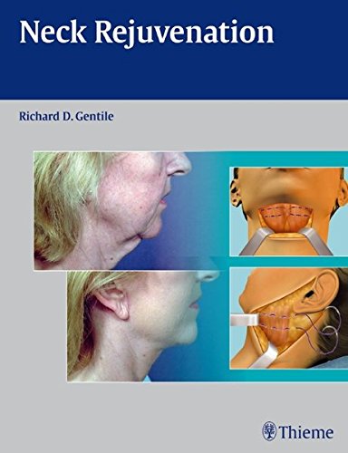 Neck Rejuvenation 1st Edition Gentile Richard D