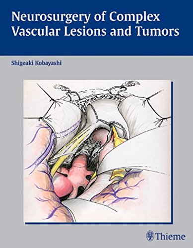 Neurosurgery Of Complex Vascular Lesions And Tumors 1st Edition Kobayashi