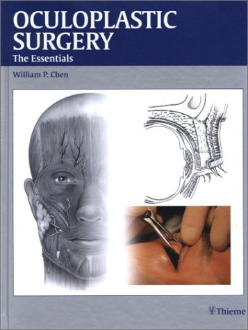 Oculoplastic Surgery The Essentials 1st Edition Chen William Paidei