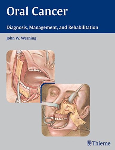 Oral Cancer Diagnosis Management And Rehabilitation 1st Edition John W Werning