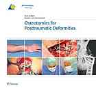 Osteotomies For Posttraumatic Deformities Ren K Marti Ronald Johannes Heerwaarden