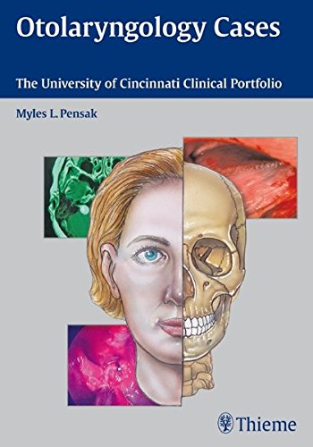 Otolaryngology Cases The University Of Cincinnati Clinical Portfolio 1st Edition Myles L Pensak