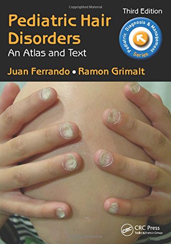 Pediatric Hair Disorders An Atlas And Text Third Edition Third Edition Juan Ferrando