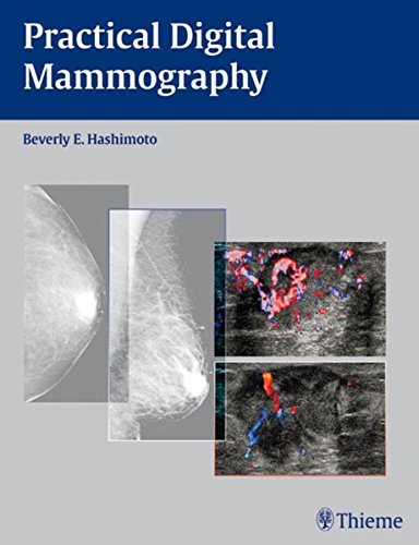 Practical Digital Mammography 1st Edition Beverly E Hashimoto