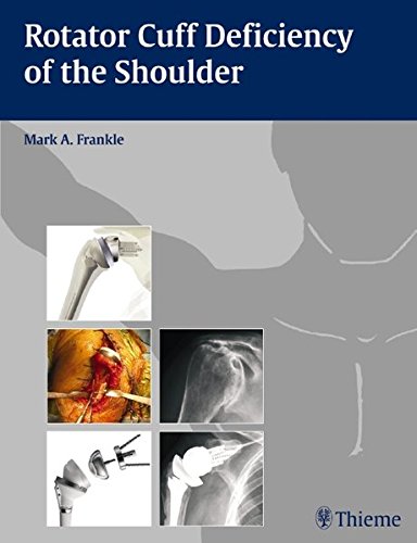 Rotator Cuff Deficiency Of The Shoulder 1st Edition Mark A Frankle