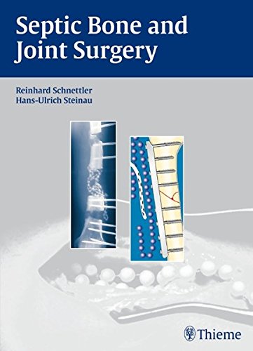 Septic Bone And Joint Surgery 1st Edition Reinhard Schnettler