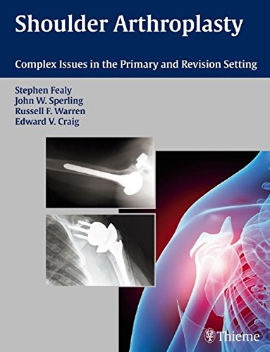 Shoulder Arthroplasty Complex Issues In The Primary And Revision Setting Stephen Fealy